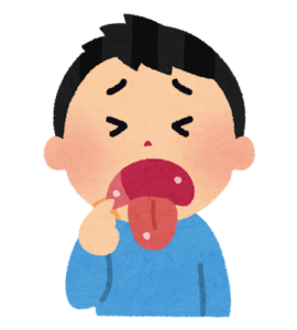 Mouth ulcer image